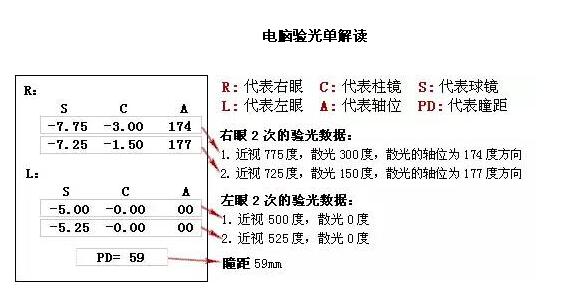 验光处方和电脑验光单分别怎么看