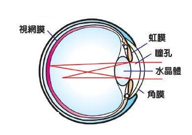 眼睛散光怎么自我恢复_亿超眼镜网